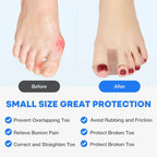 Tåseparator och hallux valgus-korrigerare 🦶