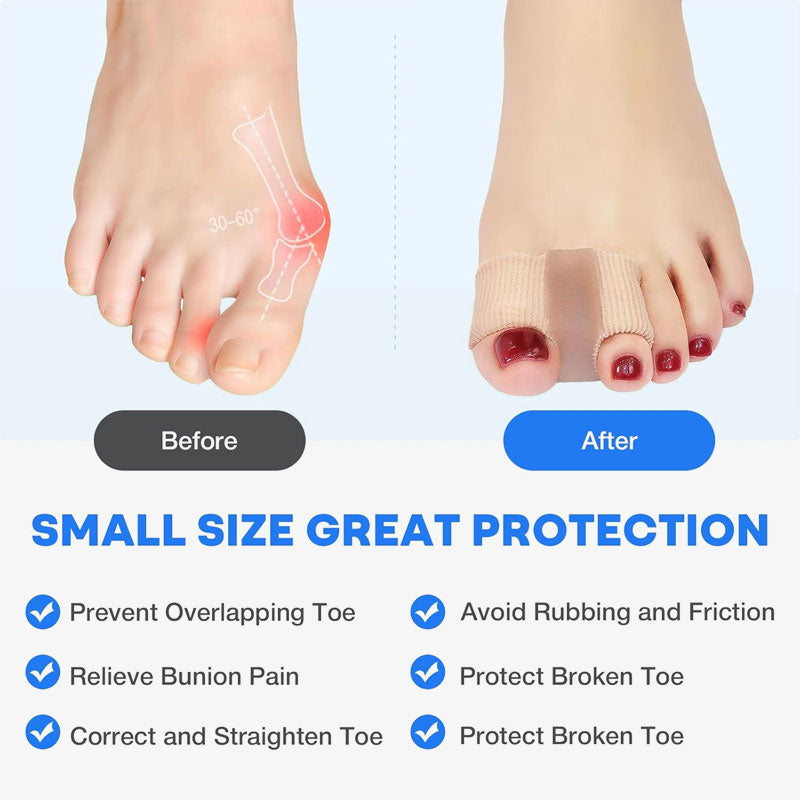 Tåseparator och hallux valgus-korrigerare 🦶